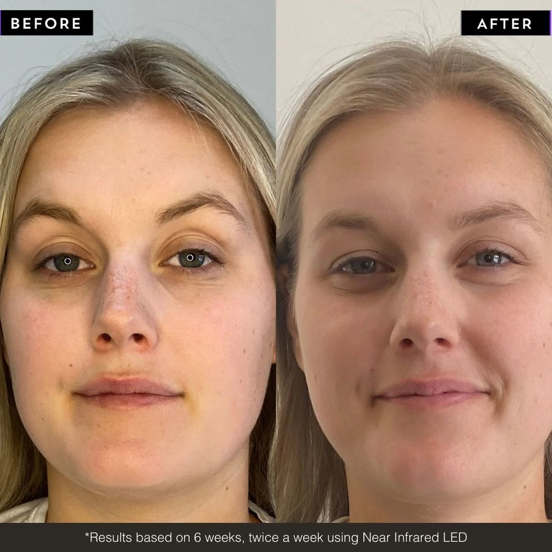 CosmeticaRX Regenix Pro