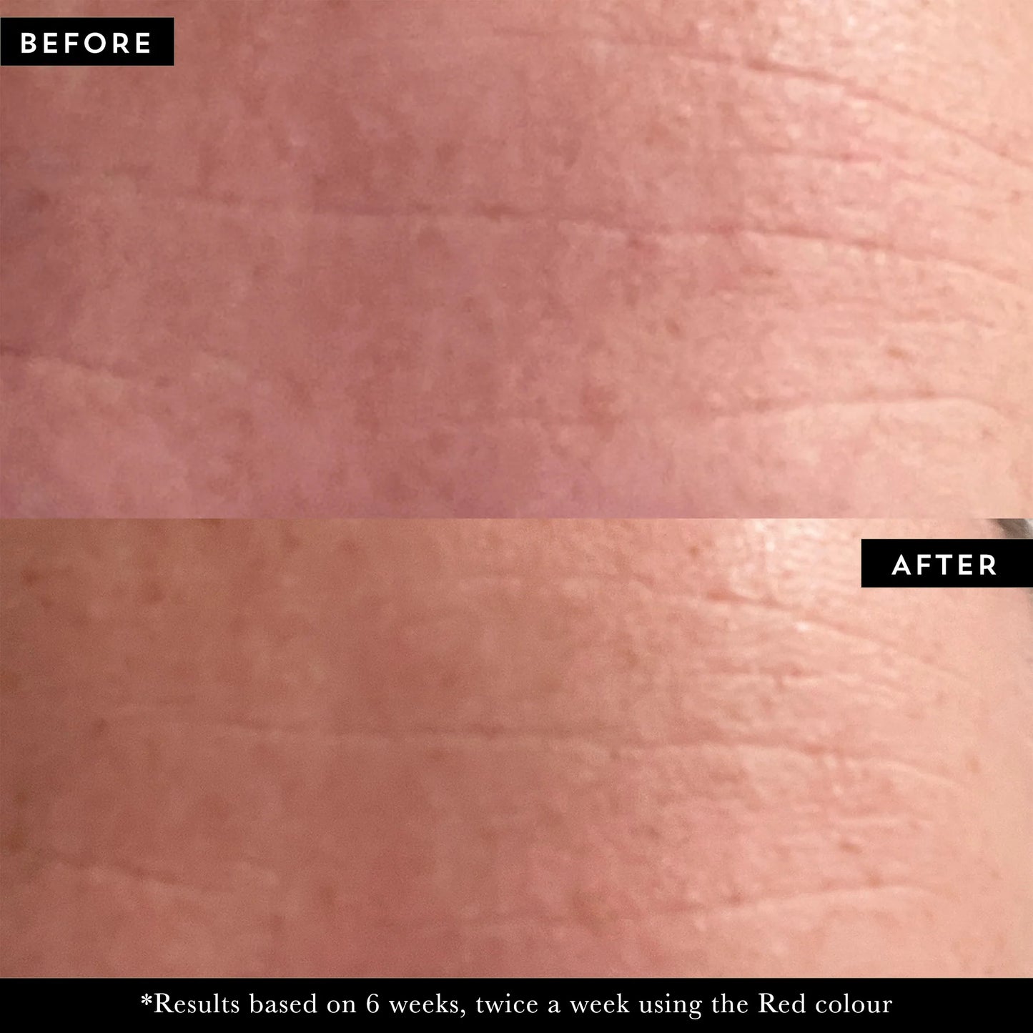 CosmeticaRX Regenix Pro