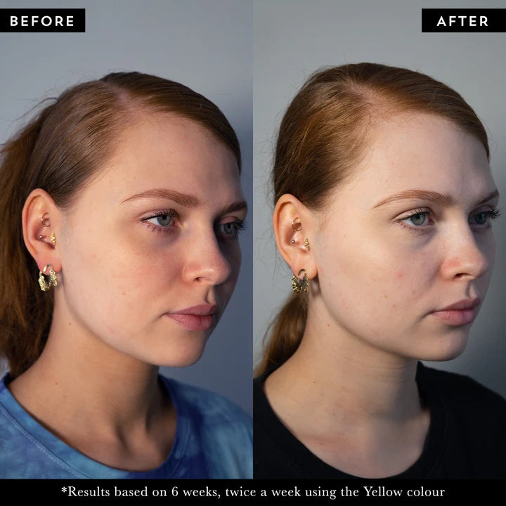 CosmeticaRX Regenix Pro